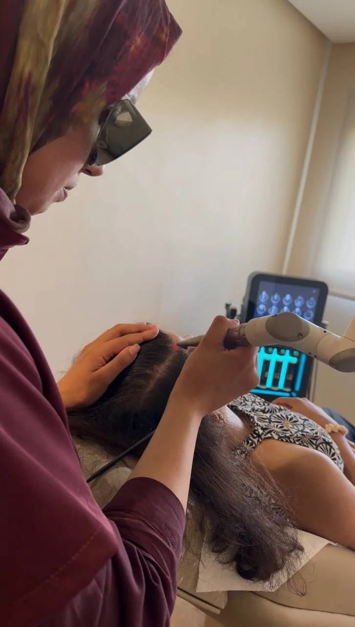 Séance de laser HairRestart sur le cuir chevelu réalisée par le Dr ESSADEQ à Rabat