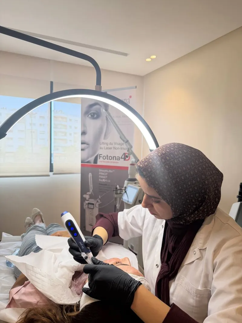Séance de microneedling réalisée par le Dr ESSADEQ au cabinet de Rabat
